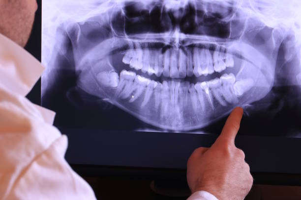 Best Dentist for Tooth Abscess  in Dorneyville, PA